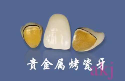 北京市公立口腔医院排行榜出炉：领先牙齿矫正、种植等领域展露华章！