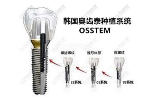 专业鞍山儿童口腔医院推荐：关注牙齿问题，这些医院值得选择！