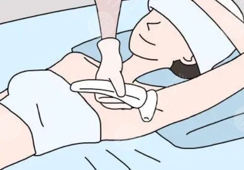 脱毛用哪种方法好？