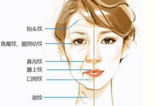 筋膜抗衰