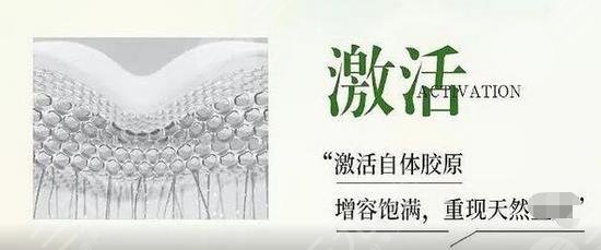 艾维岚