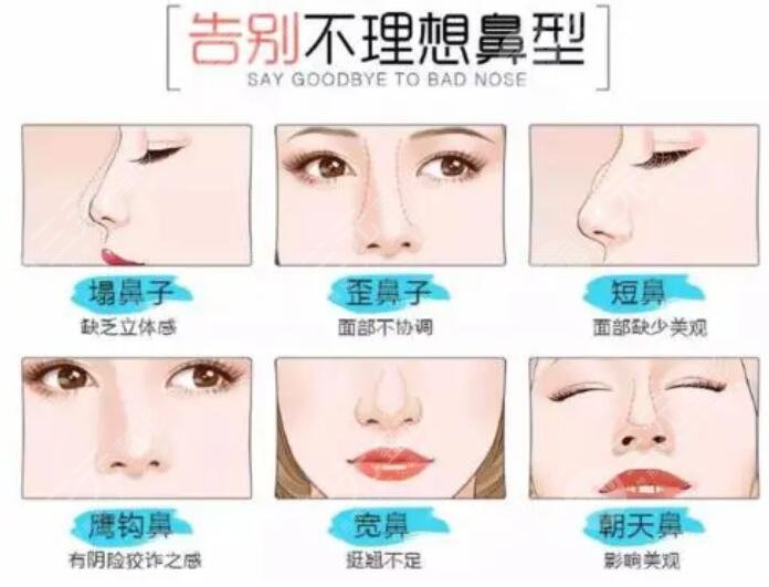 弹性连拱仿生鼻注意事项