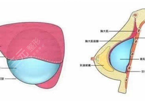 内窥镜和双平面技术要一起做吗？