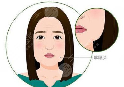嘟嘟肉打溶脂针有效果吗？