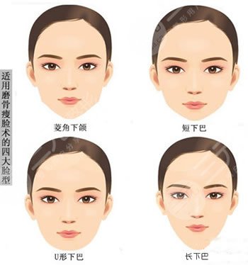 面部轮廓怎么改善？