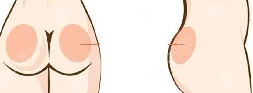 丰臀