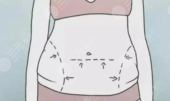 溶脂