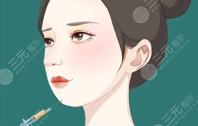 骨性玻尿酸