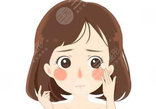 悦升线提升苹果肌能保持多久？