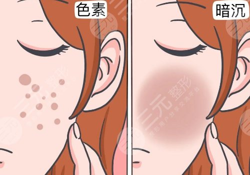 肤色暗沉的原因有哪些？