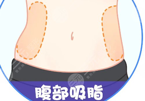 腹部抽脂术后需要修复多久？