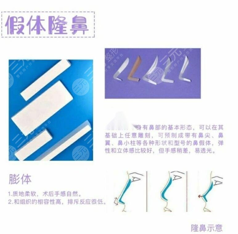 如何延长隆鼻假体的寿命?