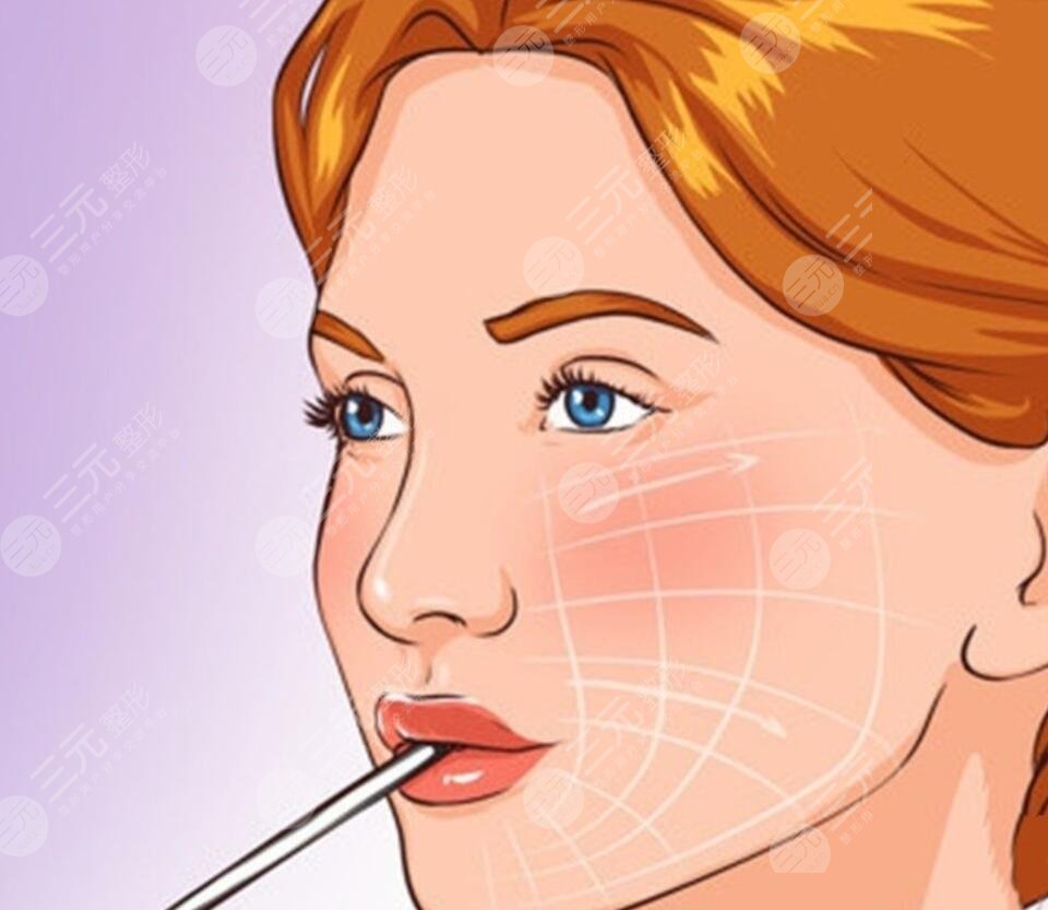 脸部皱纹怎么去除小窍门一键查询，岁月从不败勤快女人！