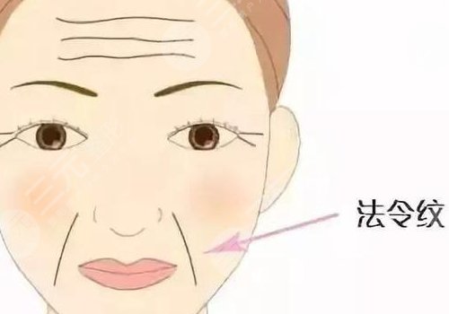 法令纹用什么填充效果好？