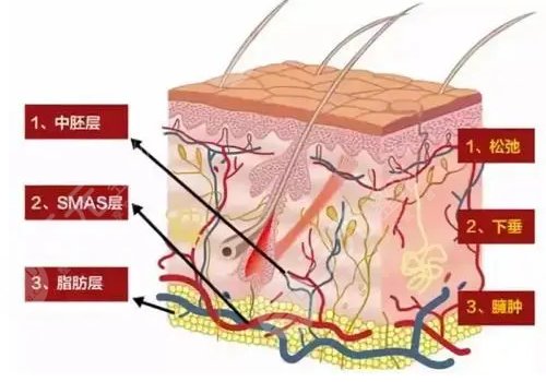 黄金热拉提和热拉提plus的区别