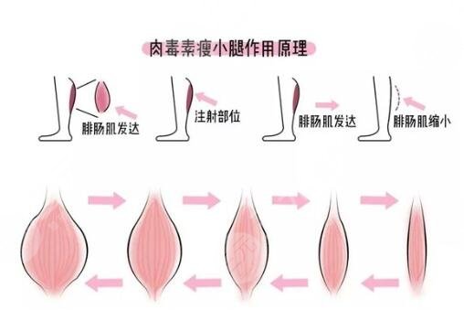 打了之后需要注意什么?