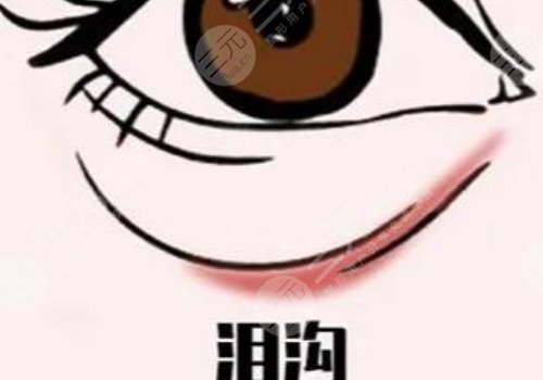 双美胶原蛋白填充泪沟能维持多久?