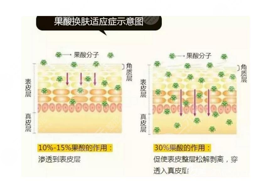 怎么收缩脸部毛孔