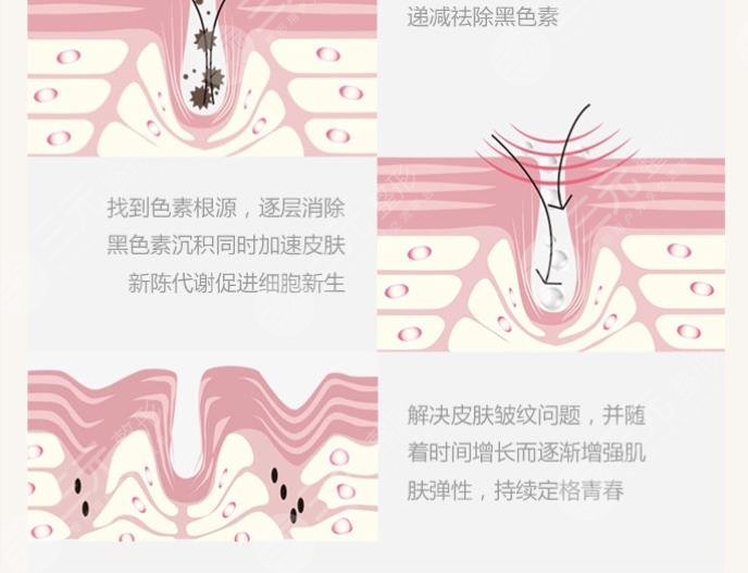 如何去除脸上的红血丝?