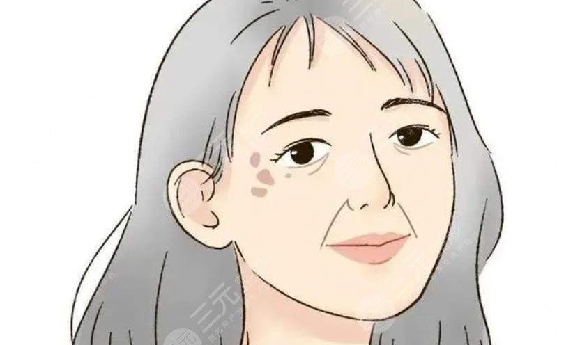 #偏方大全#怎样治老年斑?
