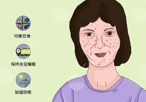 简单美白祛斑的方法有哪些？