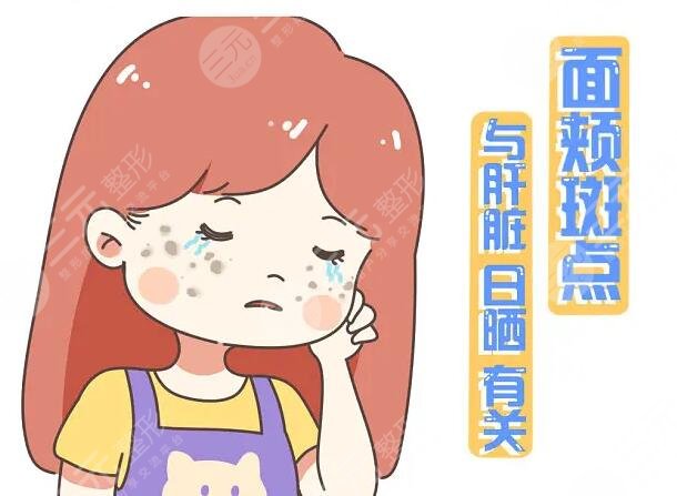 如何预防色斑的生成?
