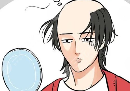 什么治疗脱发果好?