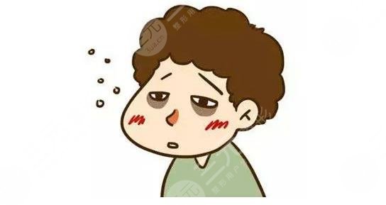 黑眼圈怎么?办?怎么消除黑眼圈
