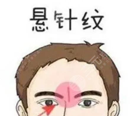 额头悬针纹
