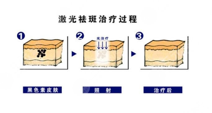 如何淡斑祛斑小妙招