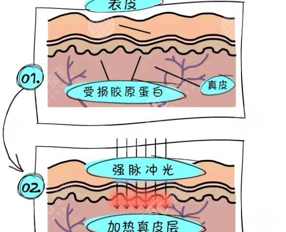 军训后如何快速美白？