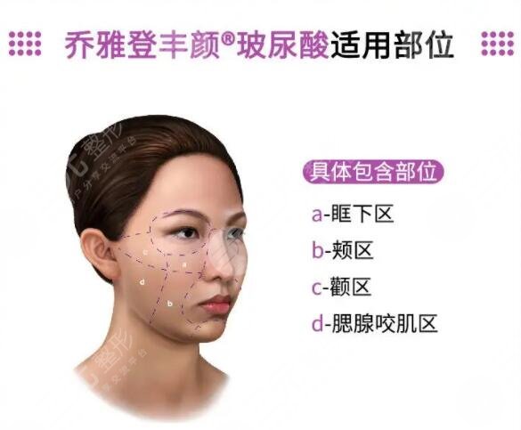 乔雅登为什么这么贵？