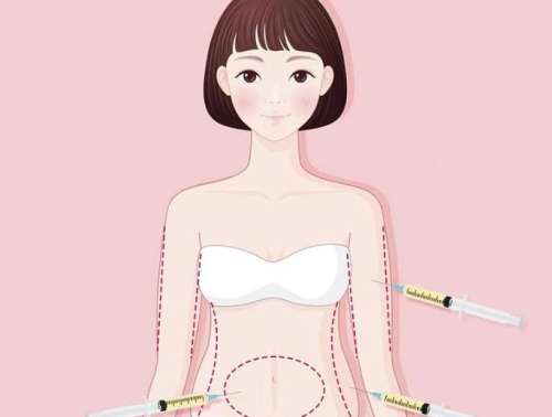 腹部吸脂.jpg